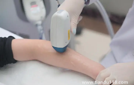 冰點(diǎn)脫毛的具體價(jià)格是多少錢1