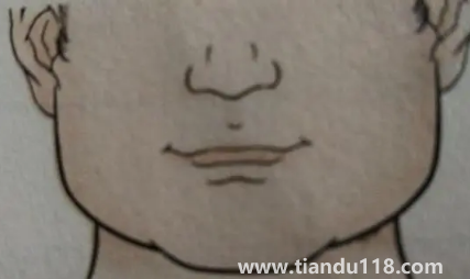 人中上的痣能去掉嗎（男人人中長痣好不好）