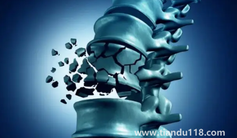 骨質(zhì)疏松癥也叫靜悄悄的流行?。ü琴|(zhì)疏松吃什么食物可以改善）