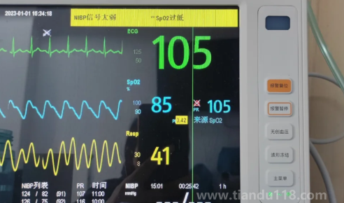 血氧飽和度一直在85行嗎（血氧瞬間80然后馬上恢復(fù)正常要緊嗎）